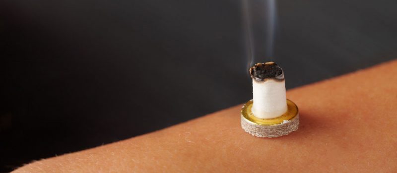 Moksibustija terapija